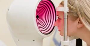 Keratoconus